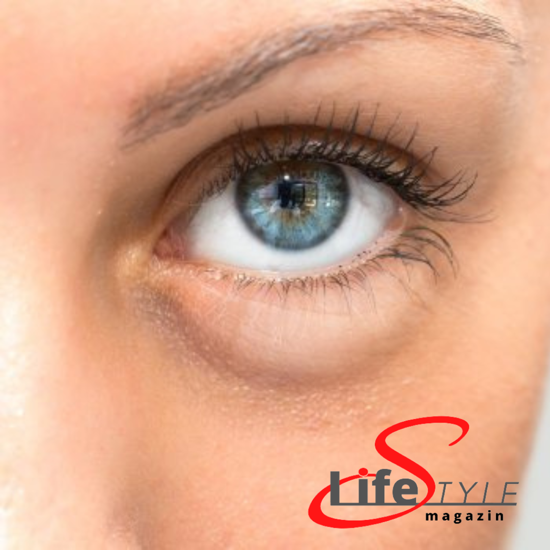 Duzzadt szem - LifestyleMagazin